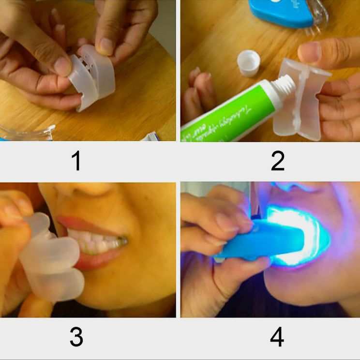 Gel blanqueador dental con férula transparente y gel en tubo verde, mostrado junto a un dispositivo LED azul.