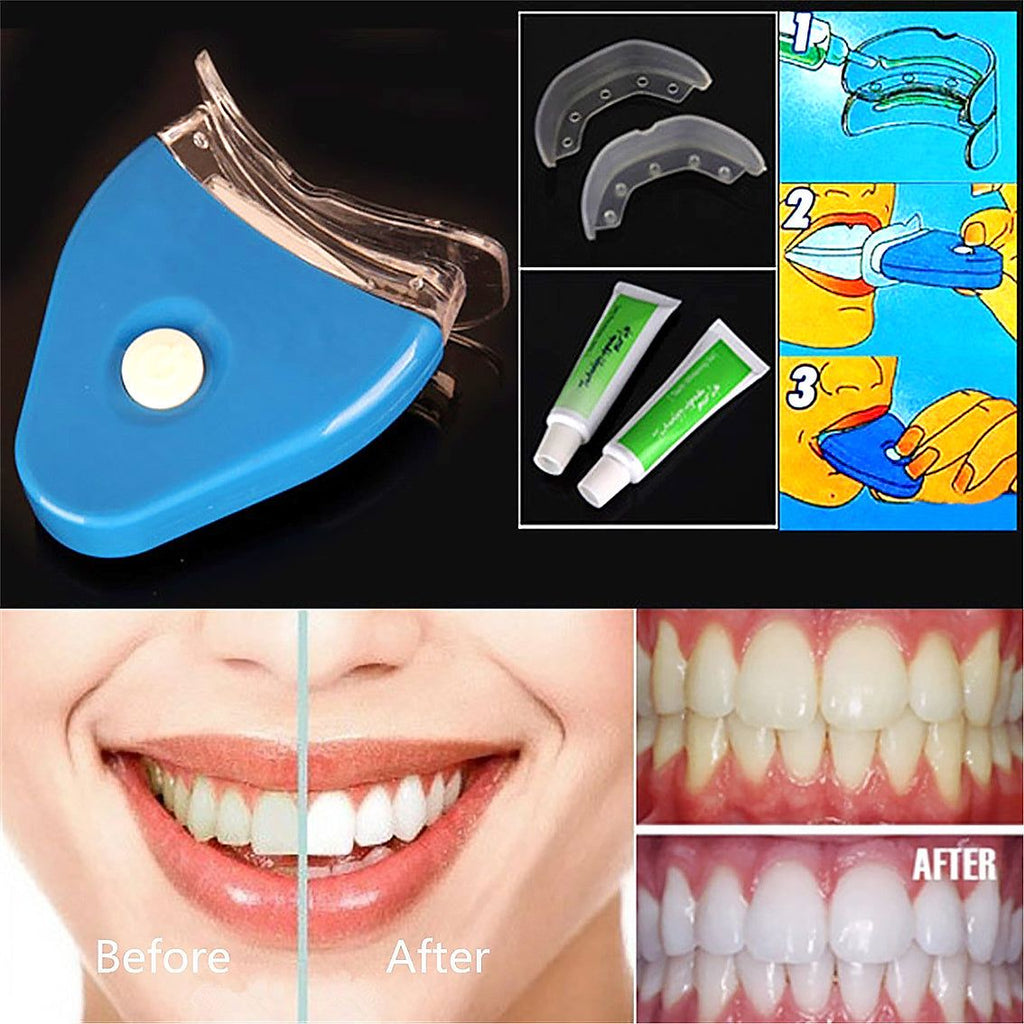 Gel blanqueador dental con férula transparente, dispositivo azul de luz LED y dos tubos de gel verde; incluye imágenes de antes y después.